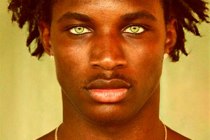 Prednisolone prednisolone and addison s disease pills